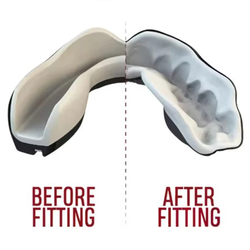 Protege dents Boxing Protection Mma Fighting Mouth Guard Children Rugby Fight Training Braces